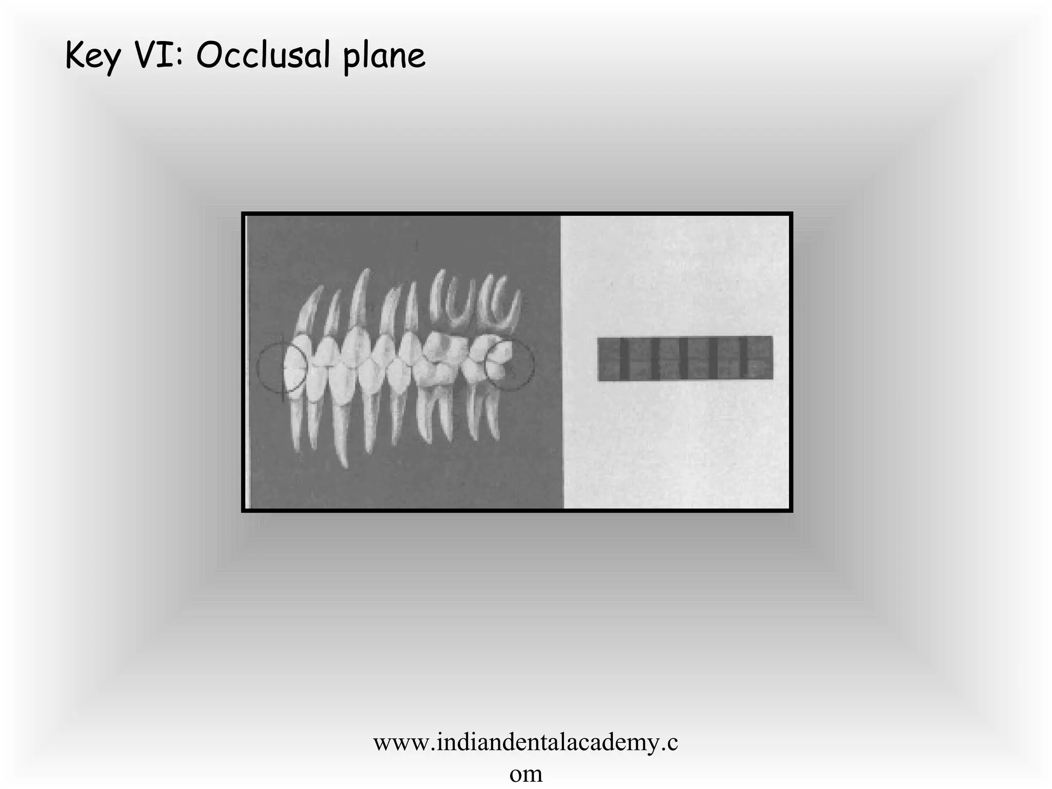 Key VI: Occlusal plane
www.indiandentalacademy.c
om
 