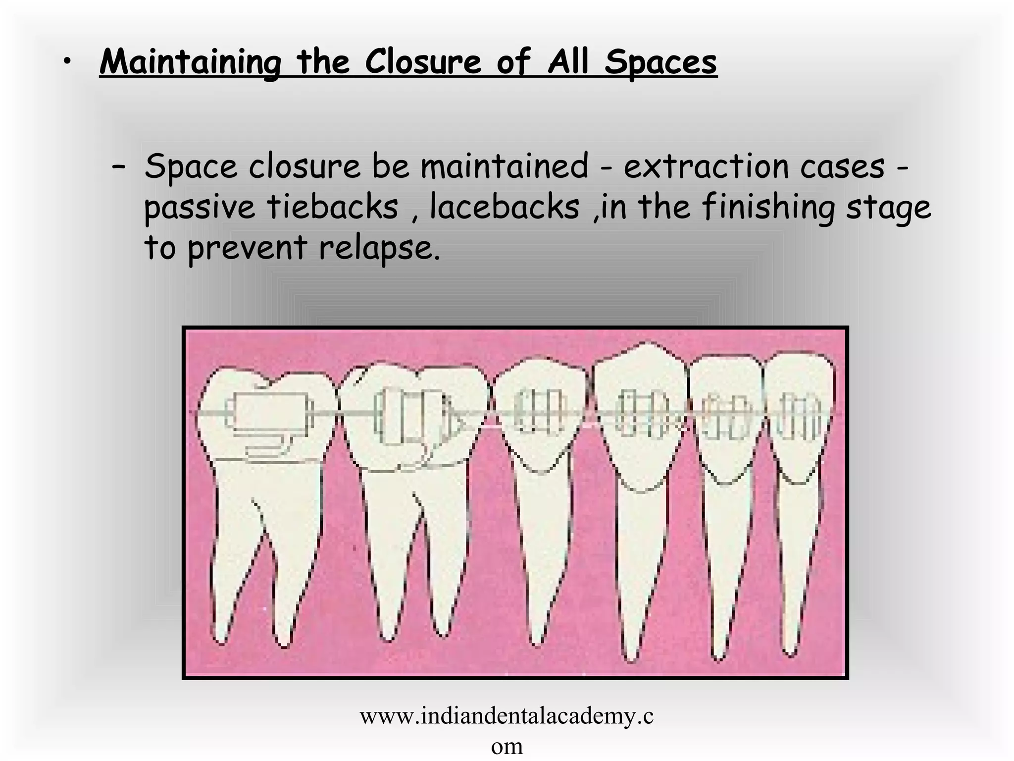 • Maintaining the Closure of All Spaces
– Space closure be maintained - extraction cases -
passive tiebacks , lacebacks ,in the finishing stage
to prevent relapse.
www.indiandentalacademy.c
om
 