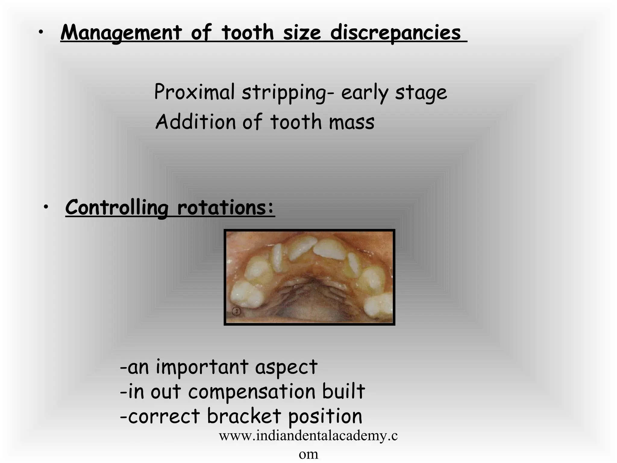 • Management of tooth size discrepancies
Proximal stripping- early stage
Addition of tooth mass
• Controlling rotations:
-an important aspect
-in out compensation built
-correct bracket position
www.indiandentalacademy.c
om
 