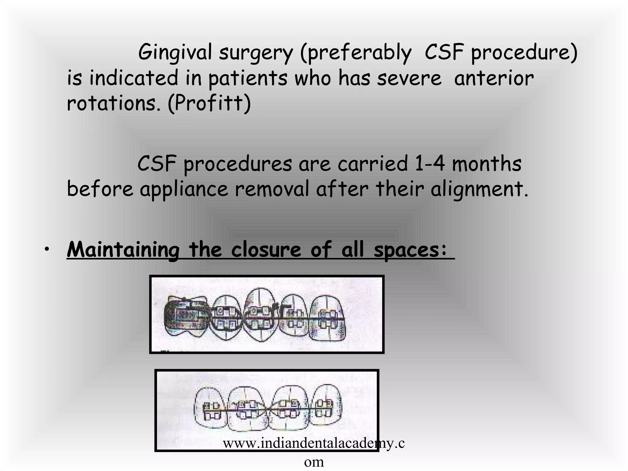 Gingival surgery (preferably CSF procedure)
is indicated in patients who has severe anterior
rotations. (Profitt)
CSF procedures are carried 1-4 months
before appliance removal after their alignment.
• Maintaining the closure of all spaces:
www.indiandentalacademy.c
om
 