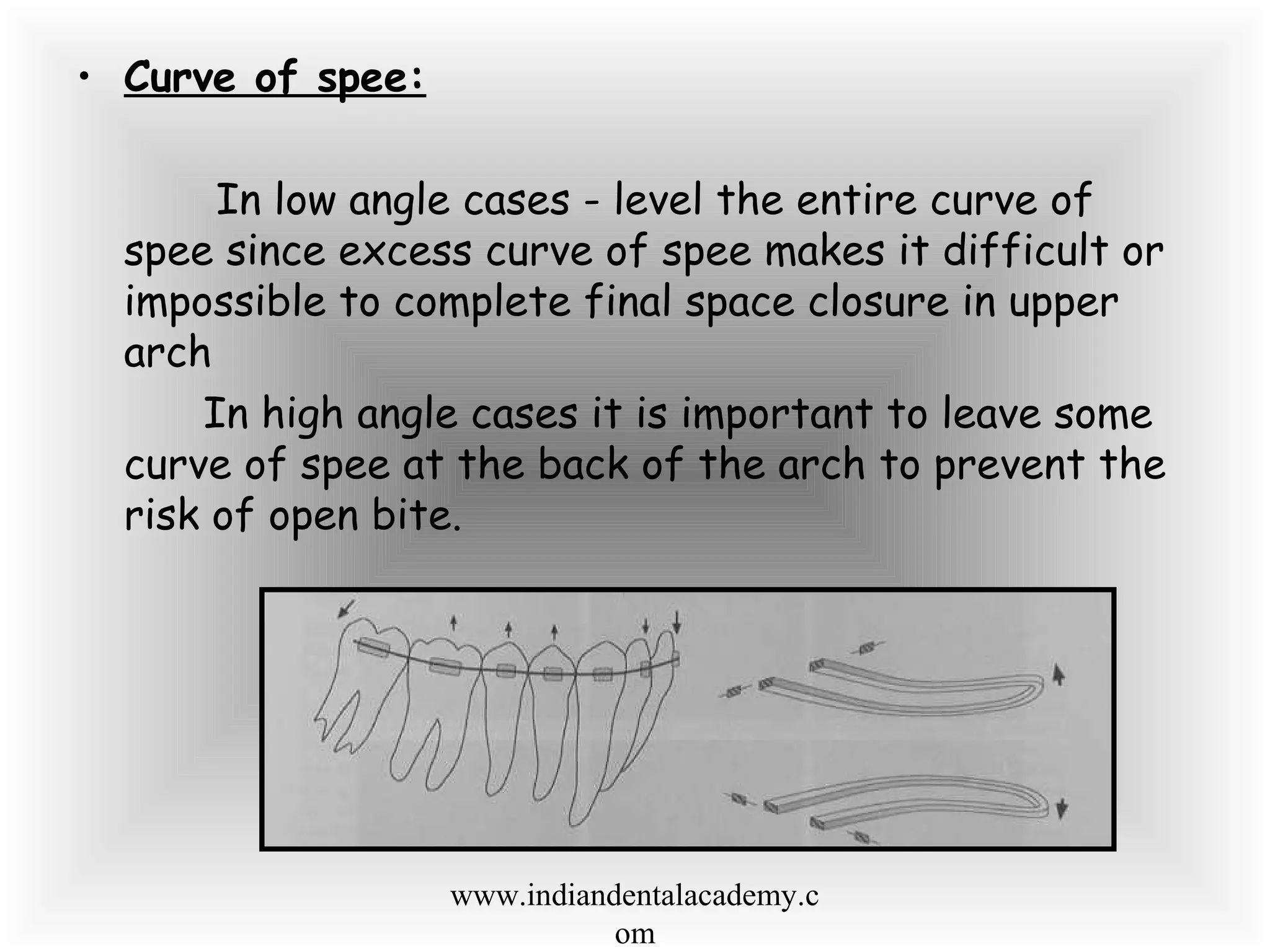 • Curve of spee:
In low angle cases - level the entire curve of
spee since excess curve of spee makes it difficult or
impossible to complete final space closure in upper
arch
In high angle cases it is important to leave some
curve of spee at the back of the arch to prevent the
risk of open bite.
www.indiandentalacademy.c
om
 