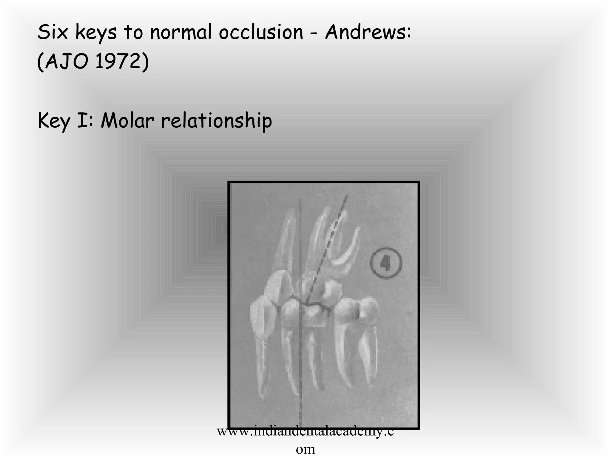 Six keys to normal occlusion - Andrews:
(AJO 1972)
Key I: Molar relationship
www.indiandentalacademy.c
om
 