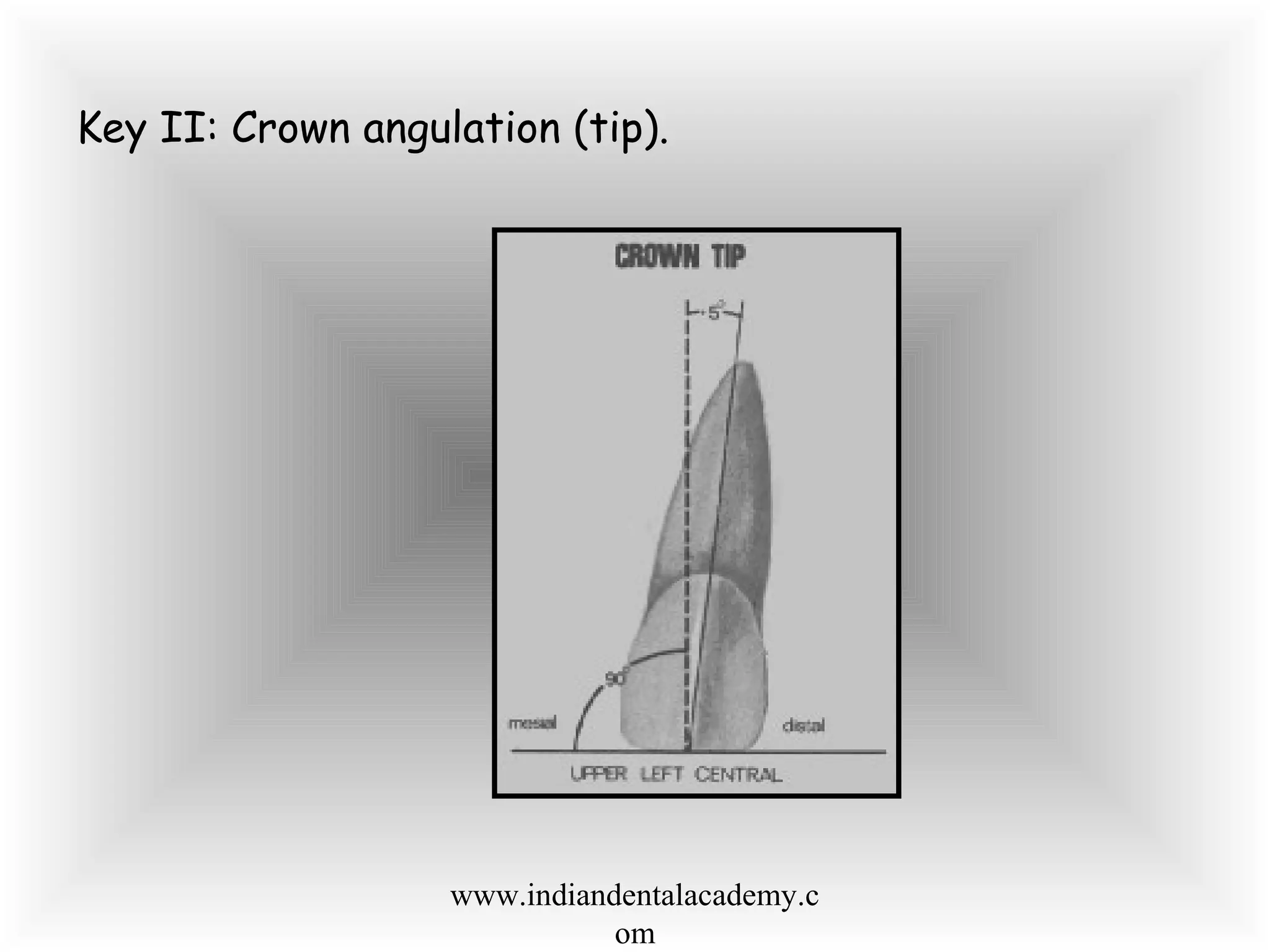 Key II: Crown angulation (tip).
www.indiandentalacademy.c
om
 