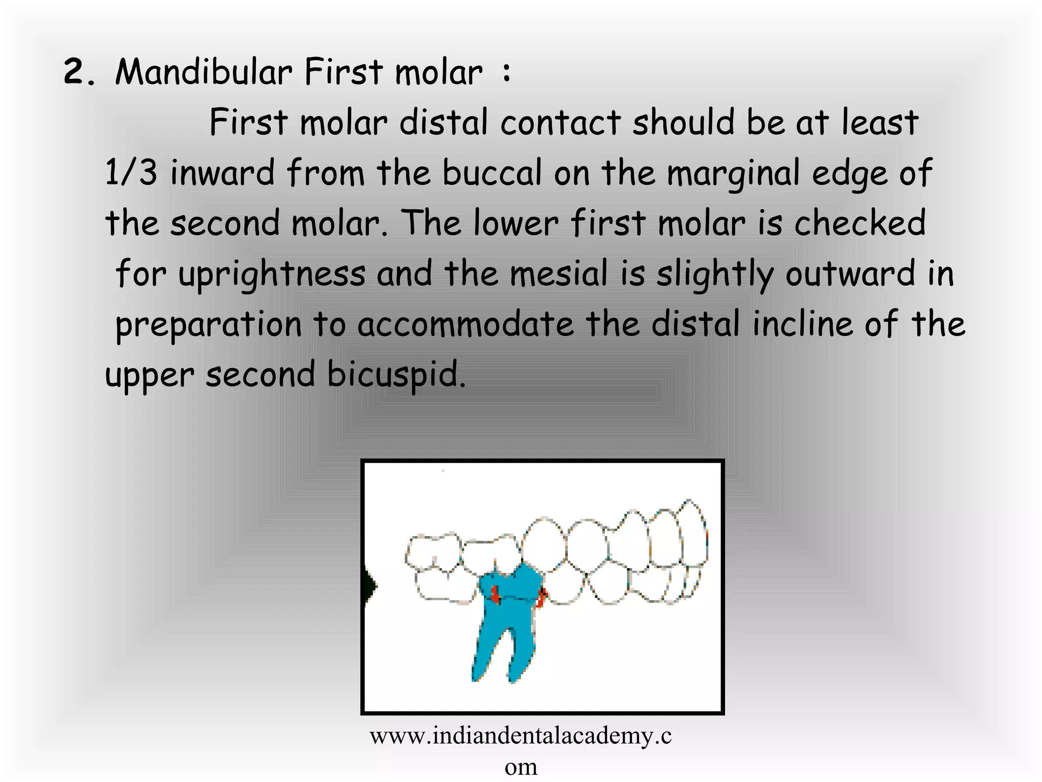 2. Mandibular First molar :
First molar distal contact should be at least
1/3 inward from the buccal on the marginal edge of
the second molar. The lower first molar is checked
for uprightness and the mesial is slightly outward in
preparation to accommodate the distal incline of the
upper second bicuspid.
www.indiandentalacademy.c
om
 
