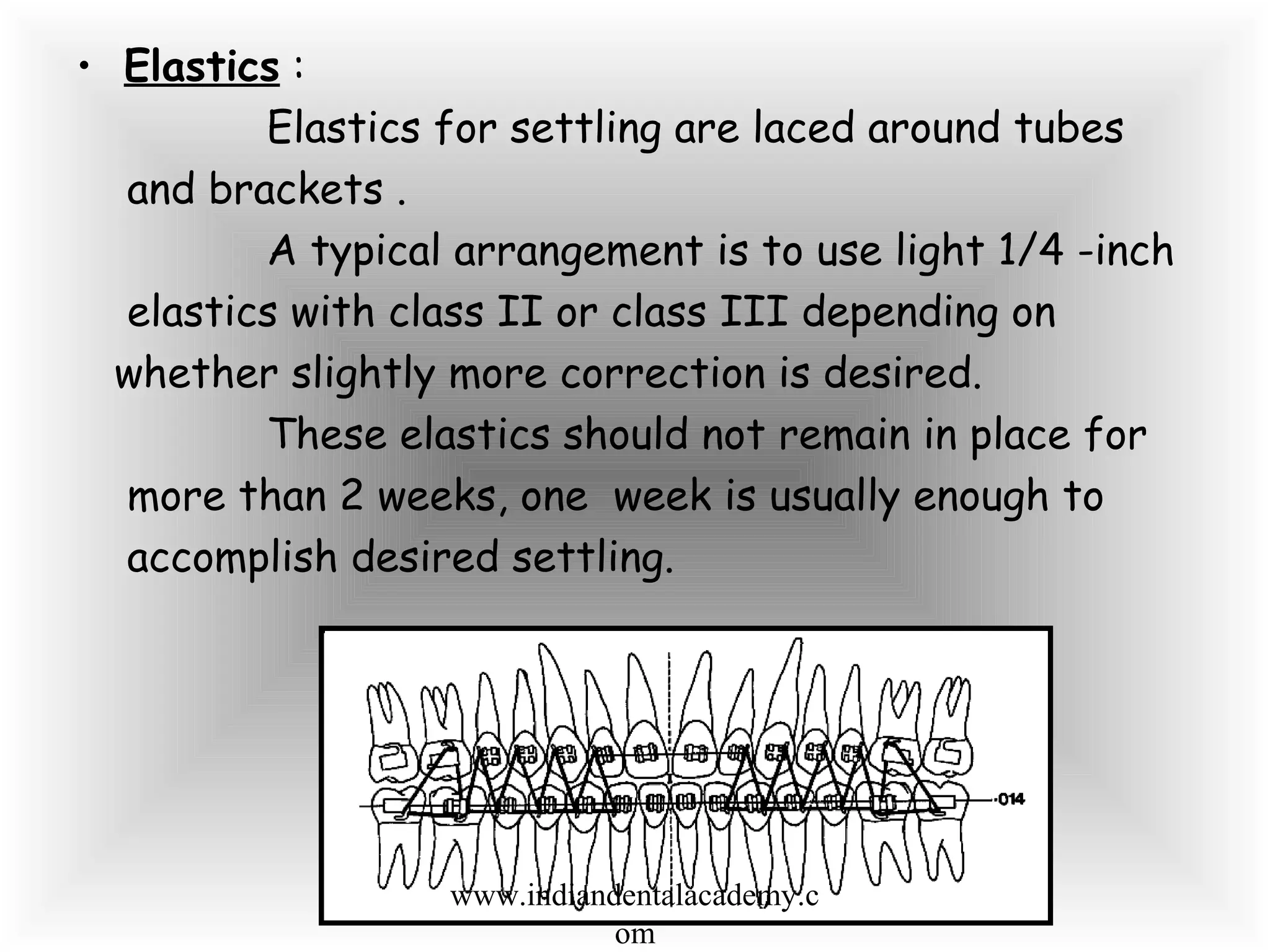 • Elastics :
Elastics for settling are laced around tubes
and brackets .
A typical arrangement is to use light 1/4 -inch
elastics with class II or class III depending on
whether slightly more correction is desired.
These elastics should not remain in place for
more than 2 weeks, one week is usually enough to
accomplish desired settling.
www.indiandentalacademy.c
om
 