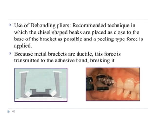 Finishing and detailing in orthodontics AV.pptx