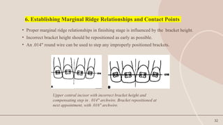 Sufficient Ridges finishing and detailing in orthodontics.pptx