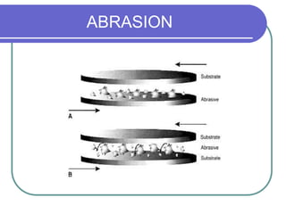 ABRASION
 