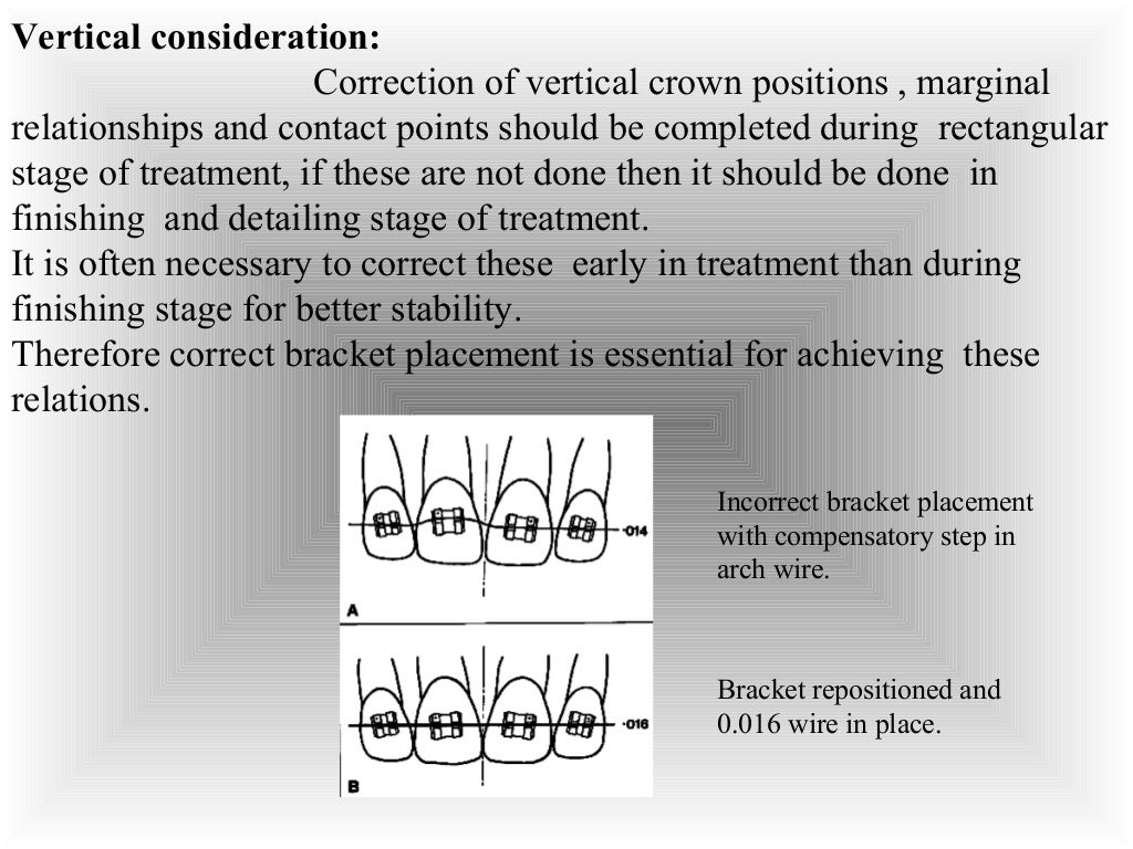 Finishing & detailing in contemporary orthodontics / fixed orthodont…
