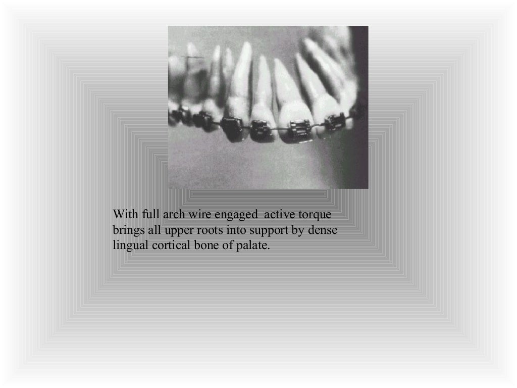 Finishing & detailing in contemporary orthodontics / fixed orthodont…