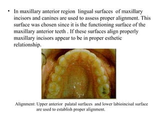 Finishing &Detaling in orthodontic treatment.ppt