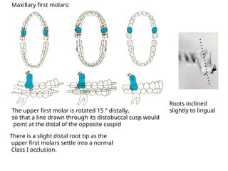 Finishing &Detaling in orthodontic treatment.ppt