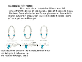 Finishing &Detaling in orthodontic treatment.ppt