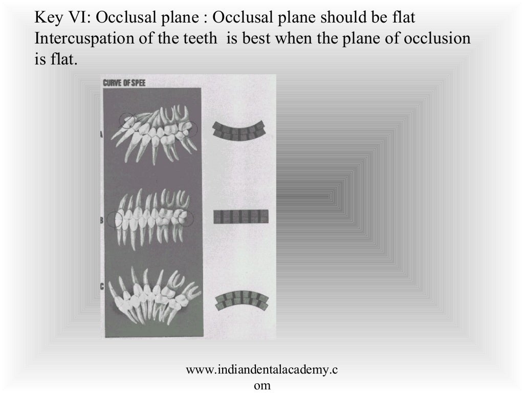 Finishing & detailing in orthodontics / fixed orthodontics course