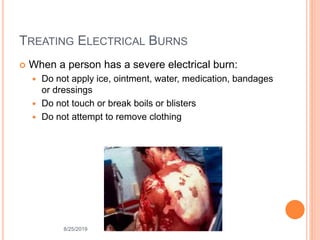 TREATING ELECTRICAL BURNS
 When a person has a severe electrical burn:
 Do not apply ice, ointment, water, medication, bandages
or dressings
 Do not touch or break boils or blisters
 Do not attempt to remove clothing
8/25/2019
 