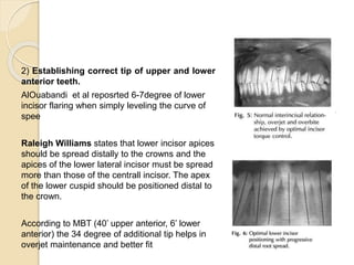Lower Apices finishing and detailing in orthodontics | PPTX