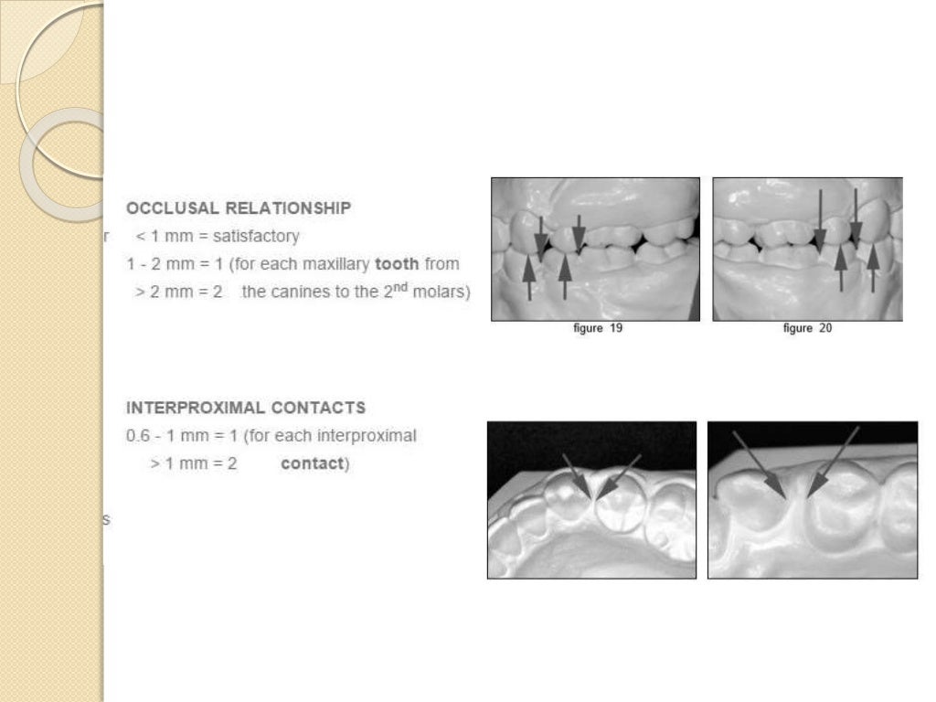 finishing and detailing in orthodontics