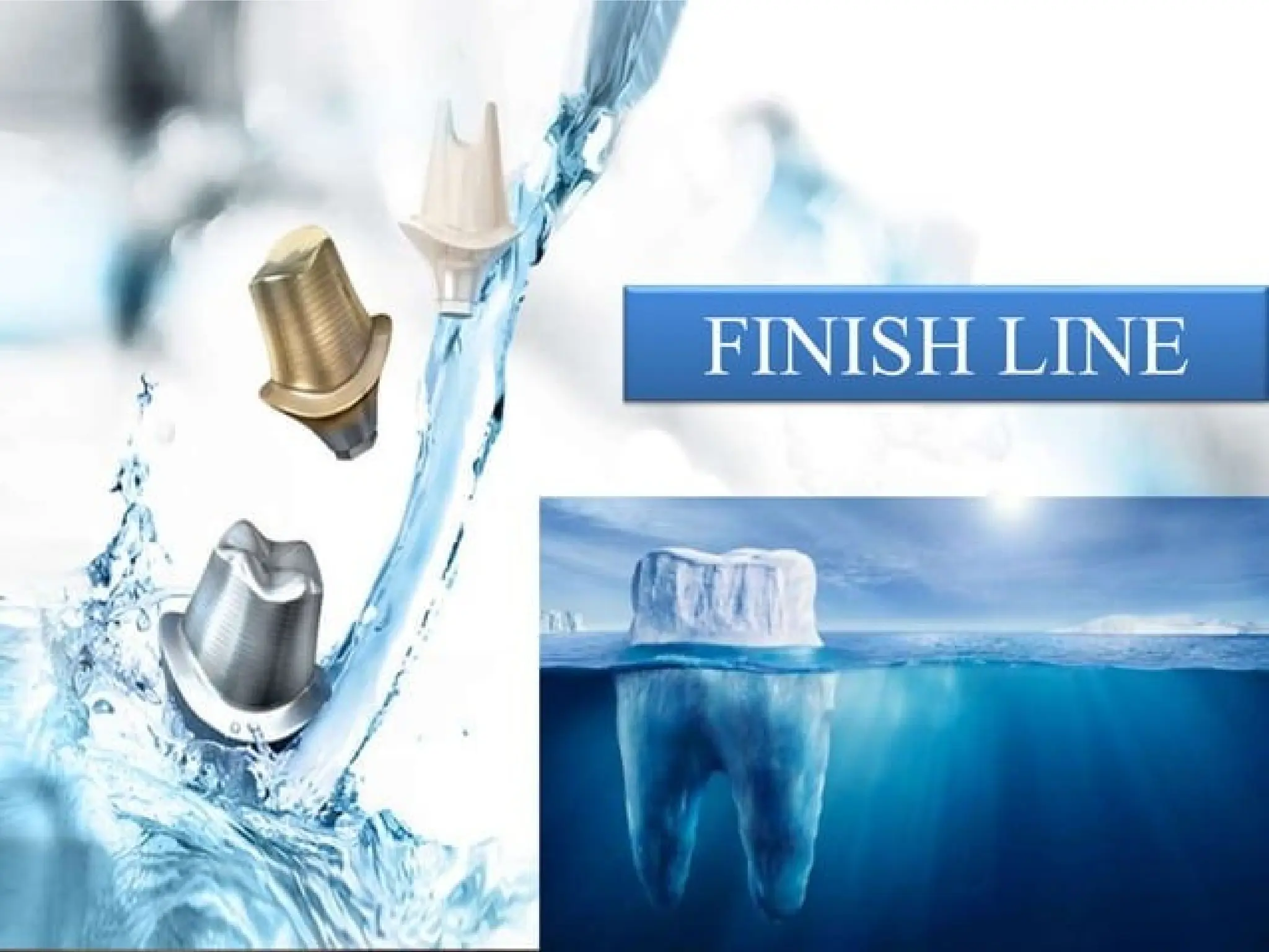 finish lines in fixed partial denture .pptx