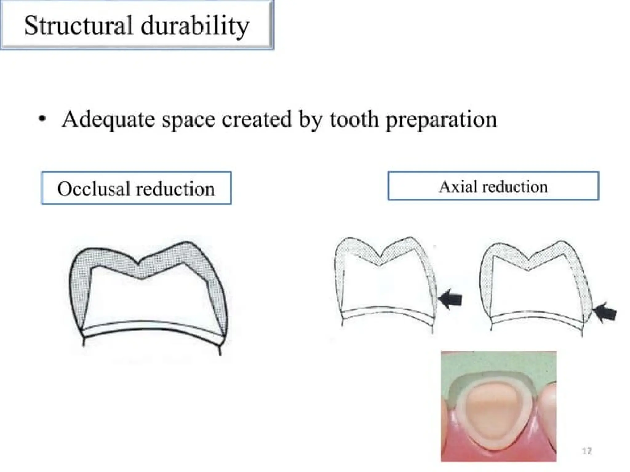 finish lines in fixed partial denture .pptx