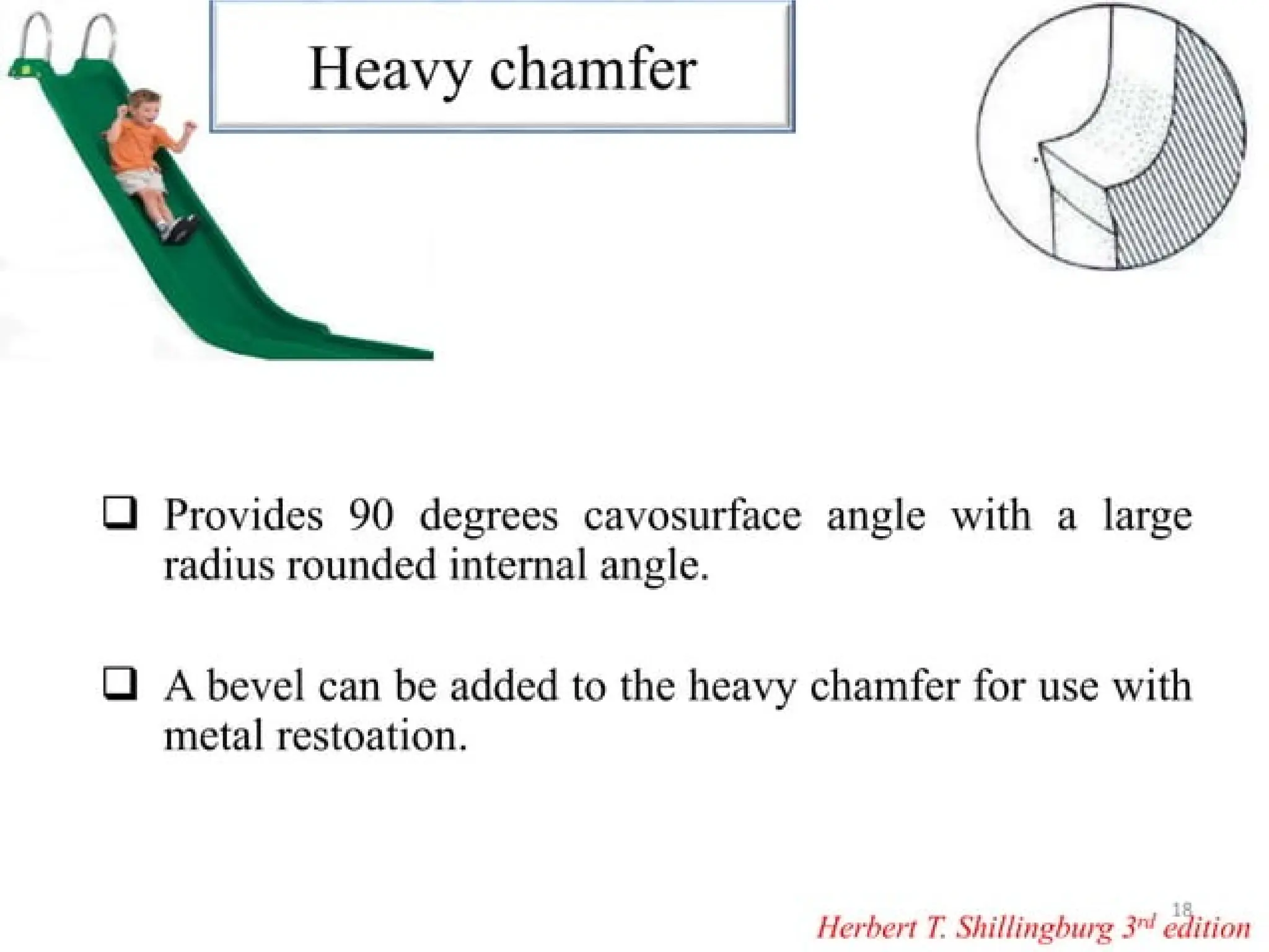 finish lines in fixed partial denture .pptx