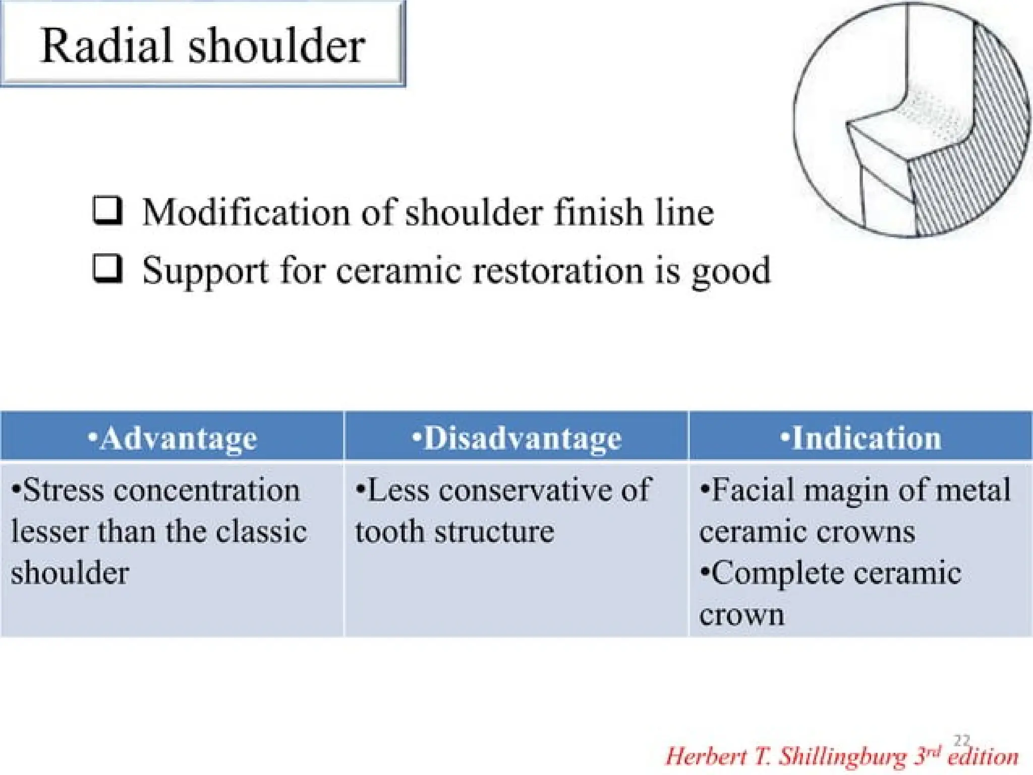 finish lines in fixed partial denture .pptx