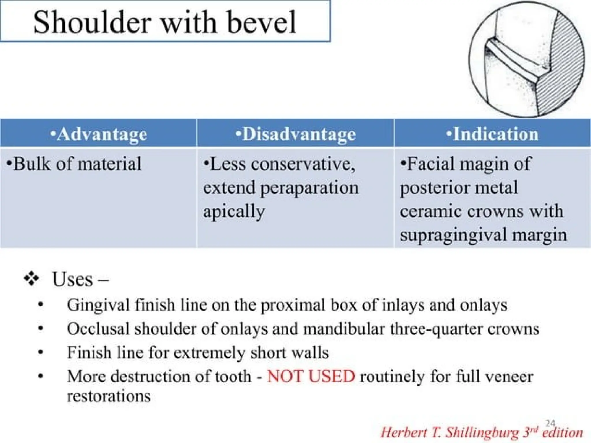 finish lines in fixed partial denture .pptx