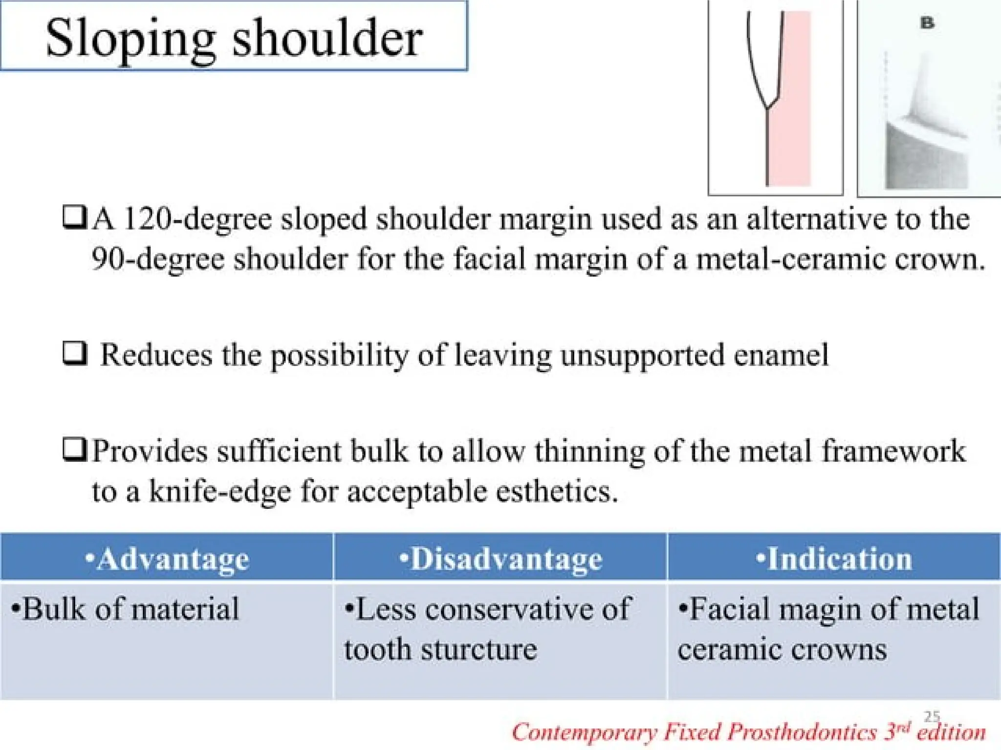 finish lines in fixed partial denture .pptx