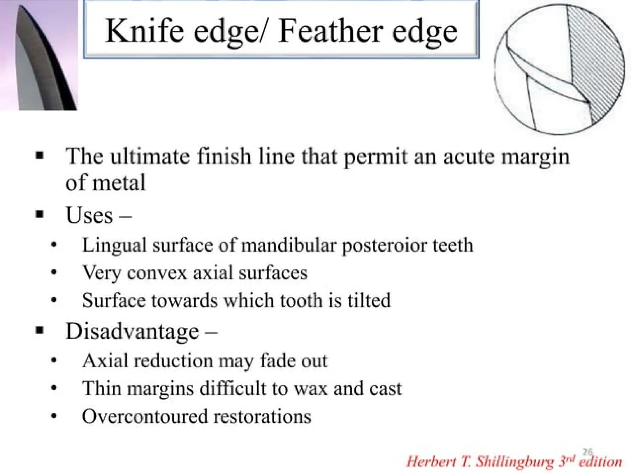 finish lines in fixed partial denture .pptx