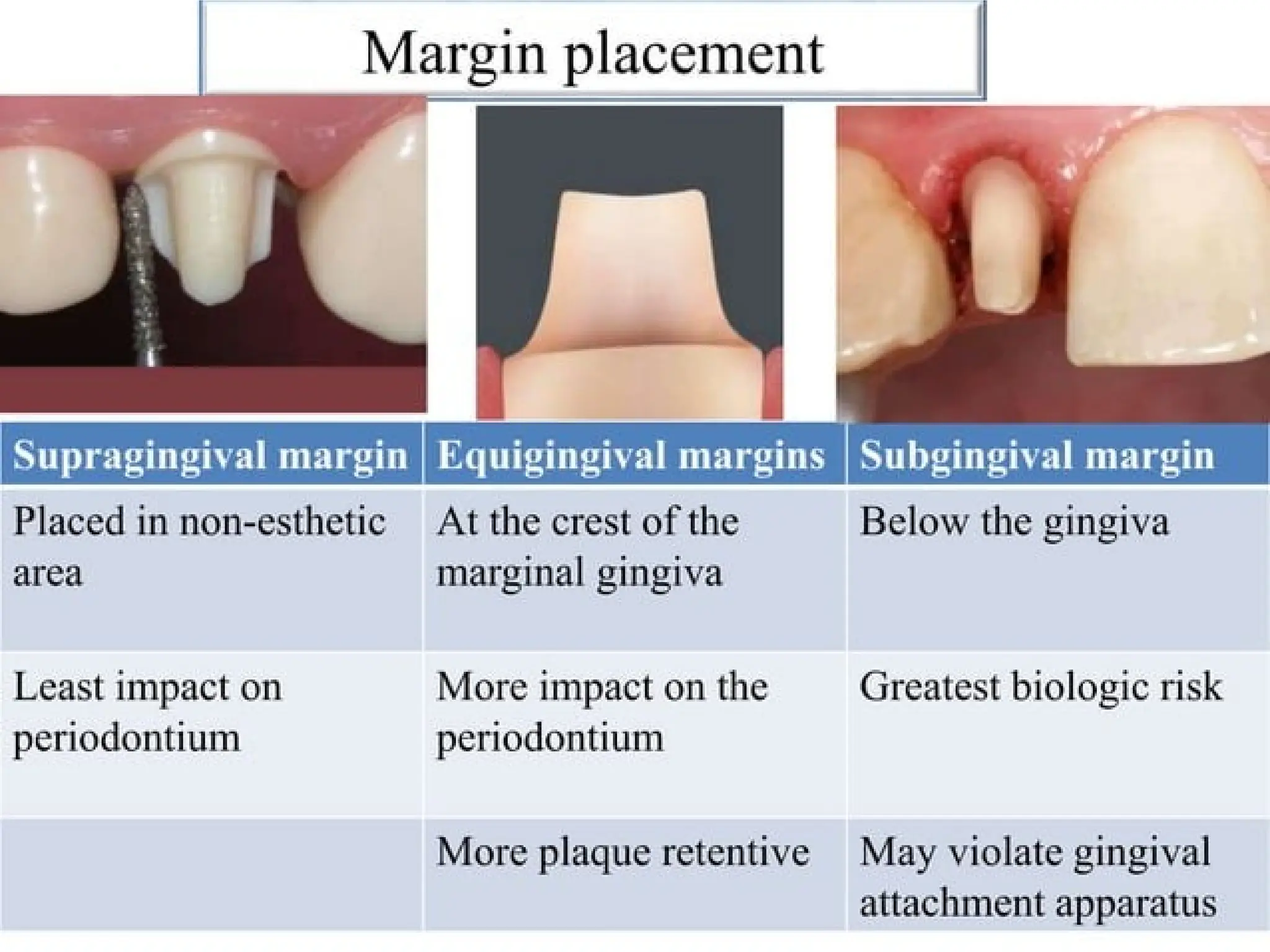 finish lines in fixed partial denture .pptx