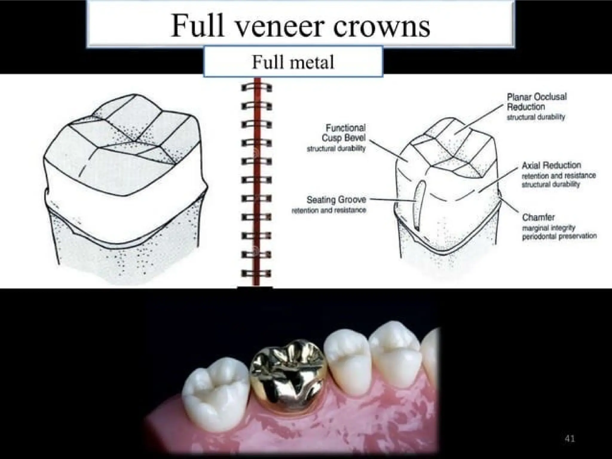 finish lines in fixed partial denture .pptx