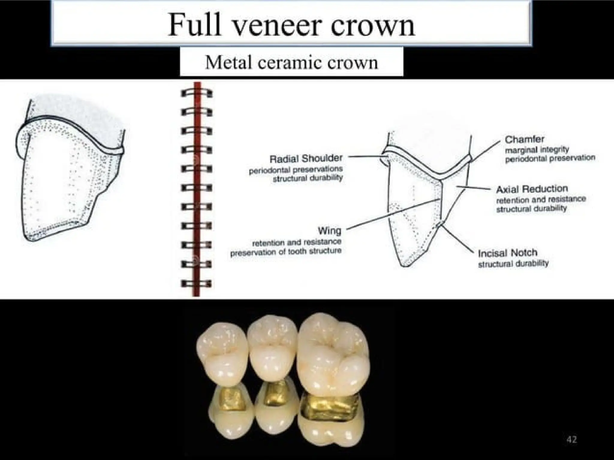 finish lines in fixed partial denture .pptx
