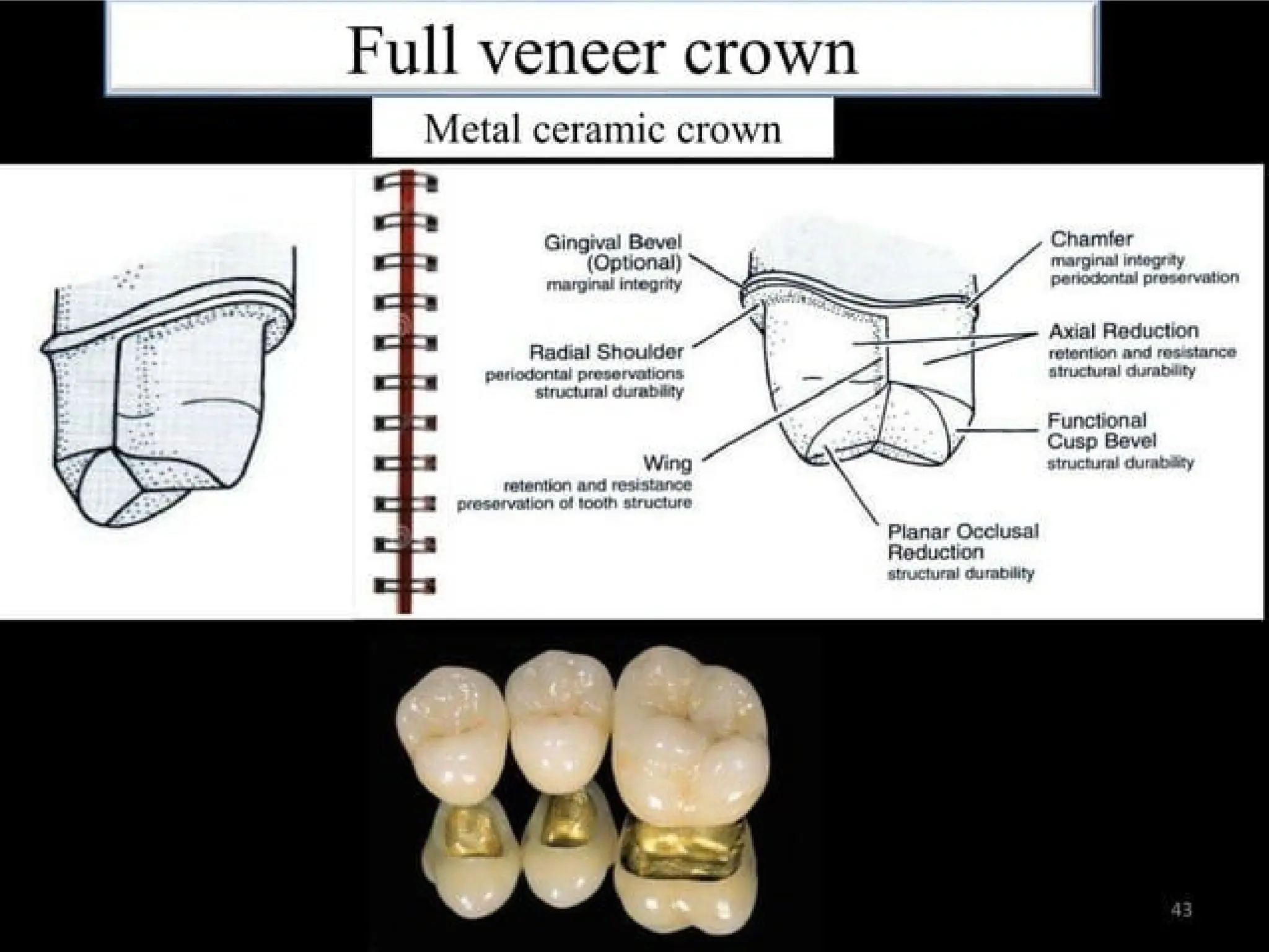 finish lines in fixed partial denture .pptx