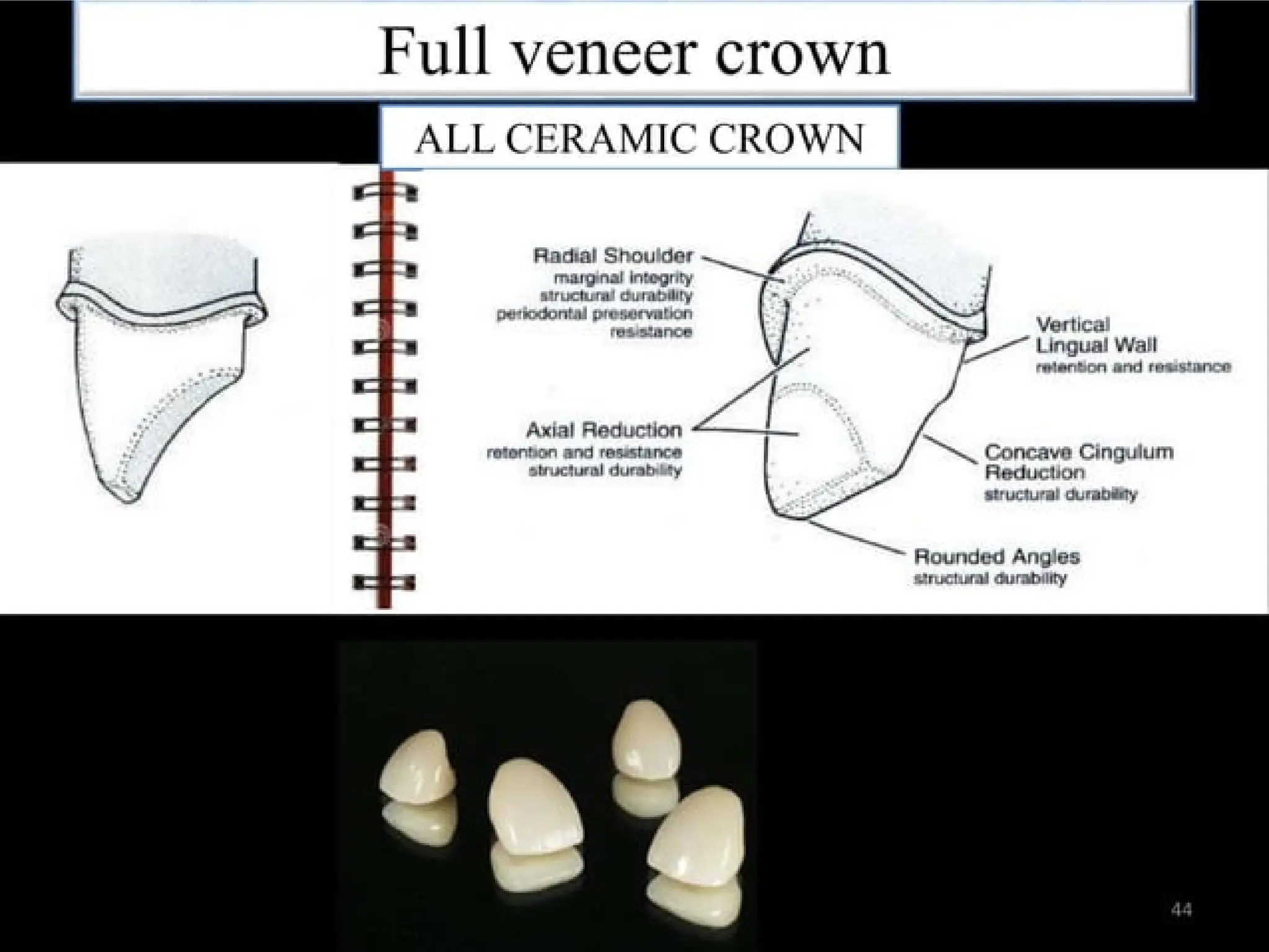 finish lines in fixed partial denture .pptx