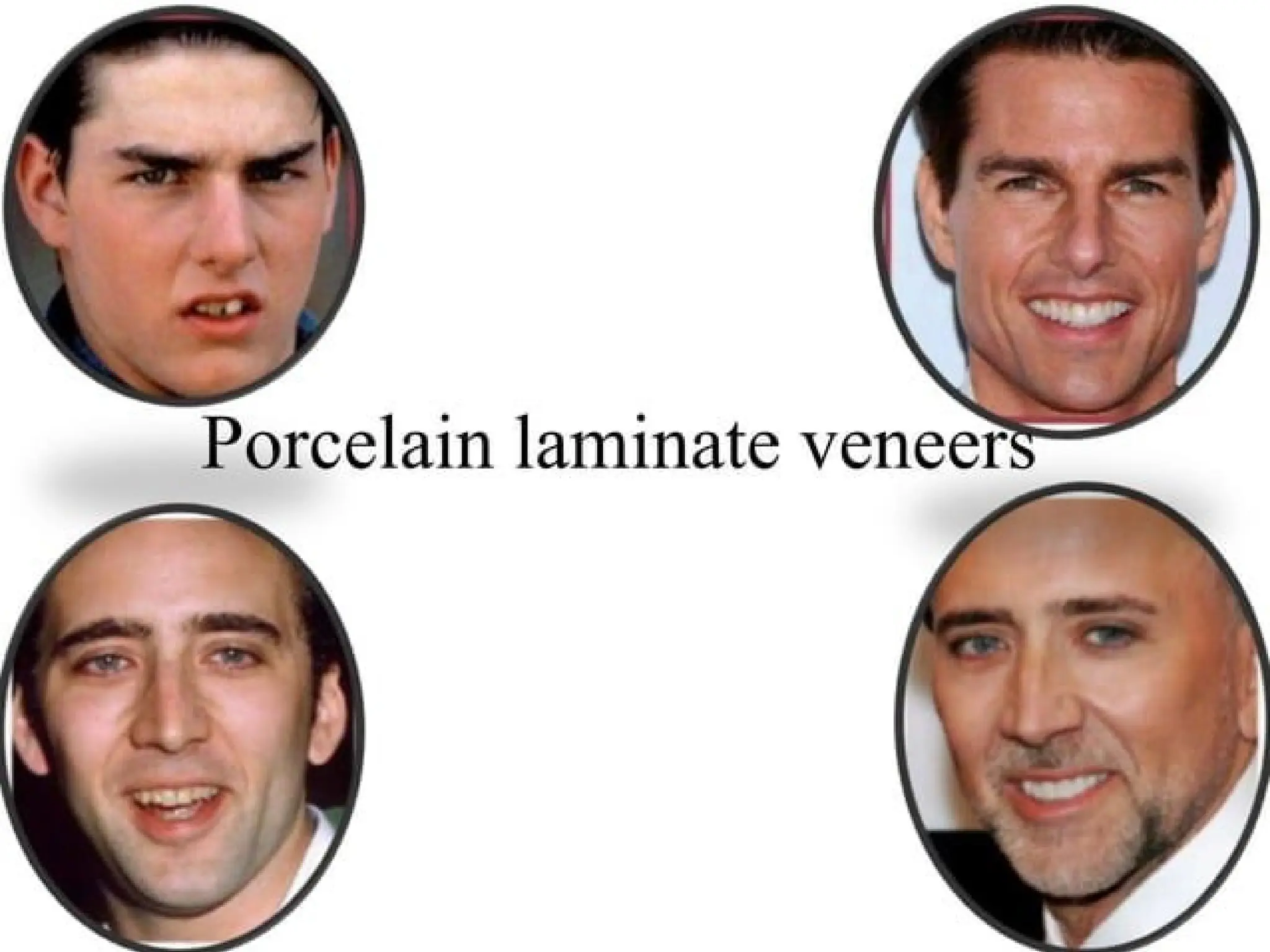 finish lines in fixed partial denture .pptx