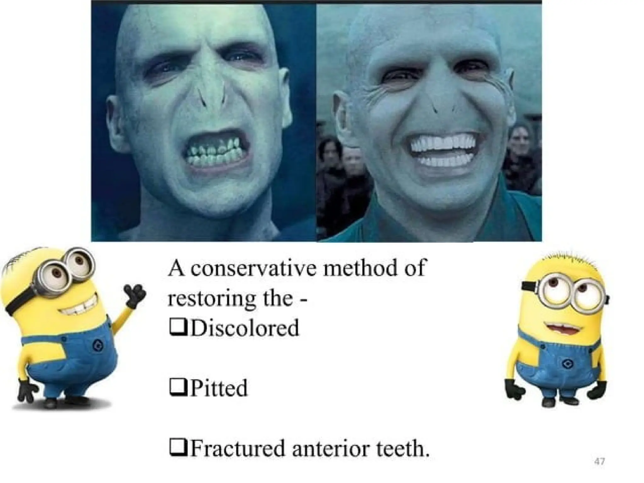 finish lines in fixed partial denture .pptx