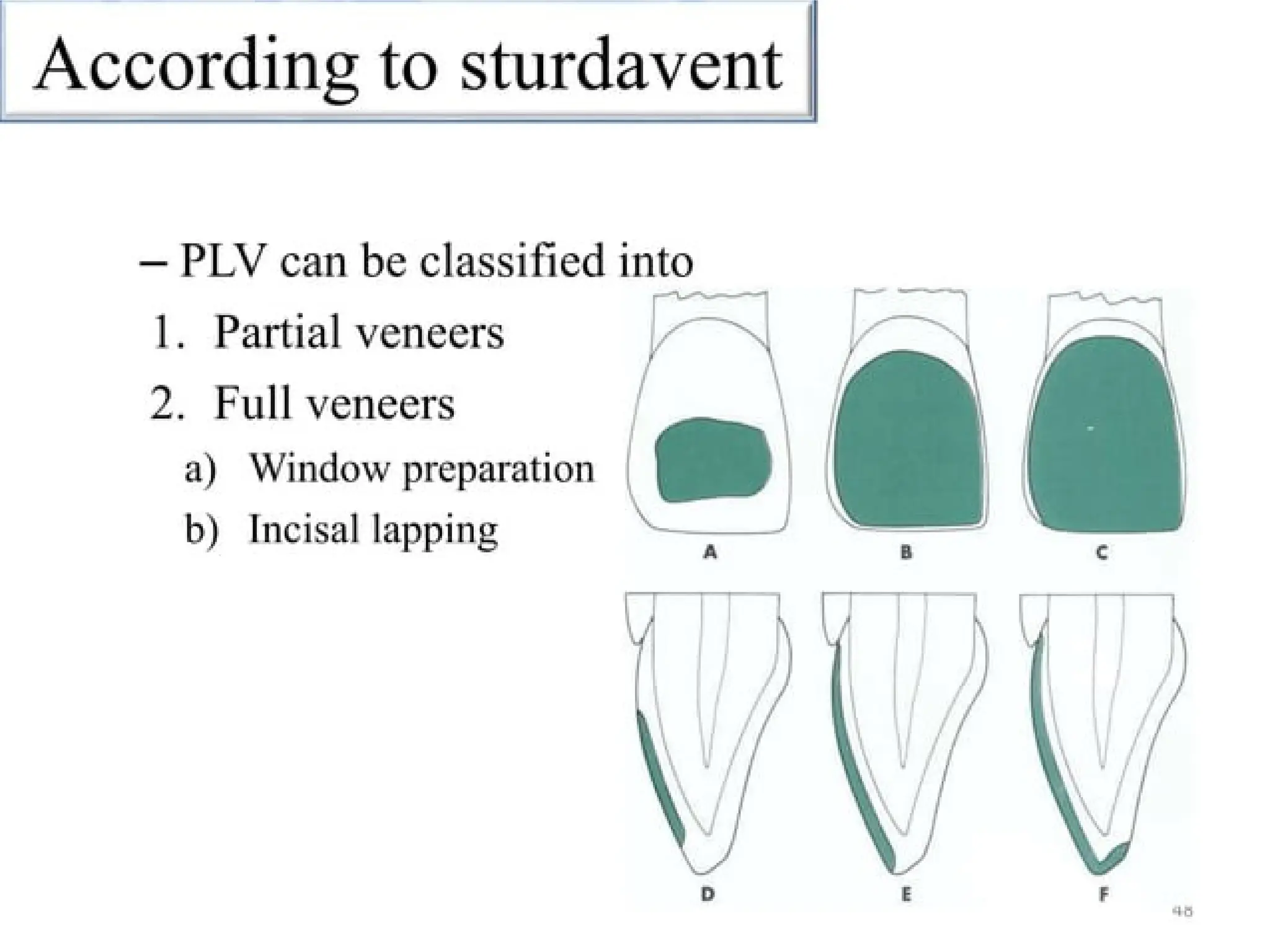 finish lines in fixed partial denture .pptx