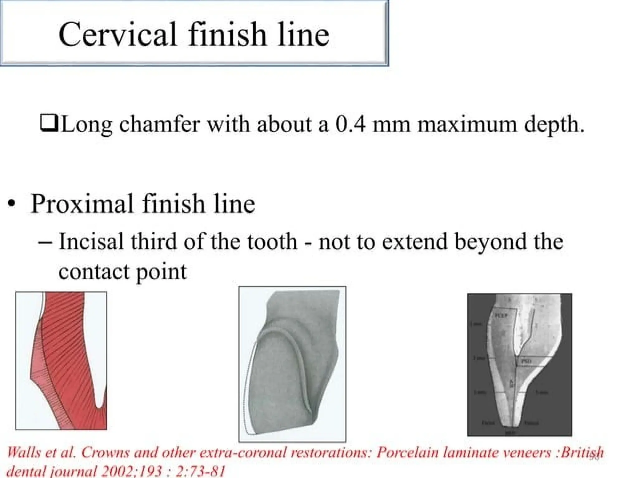 finish lines in fixed partial denture .pptx