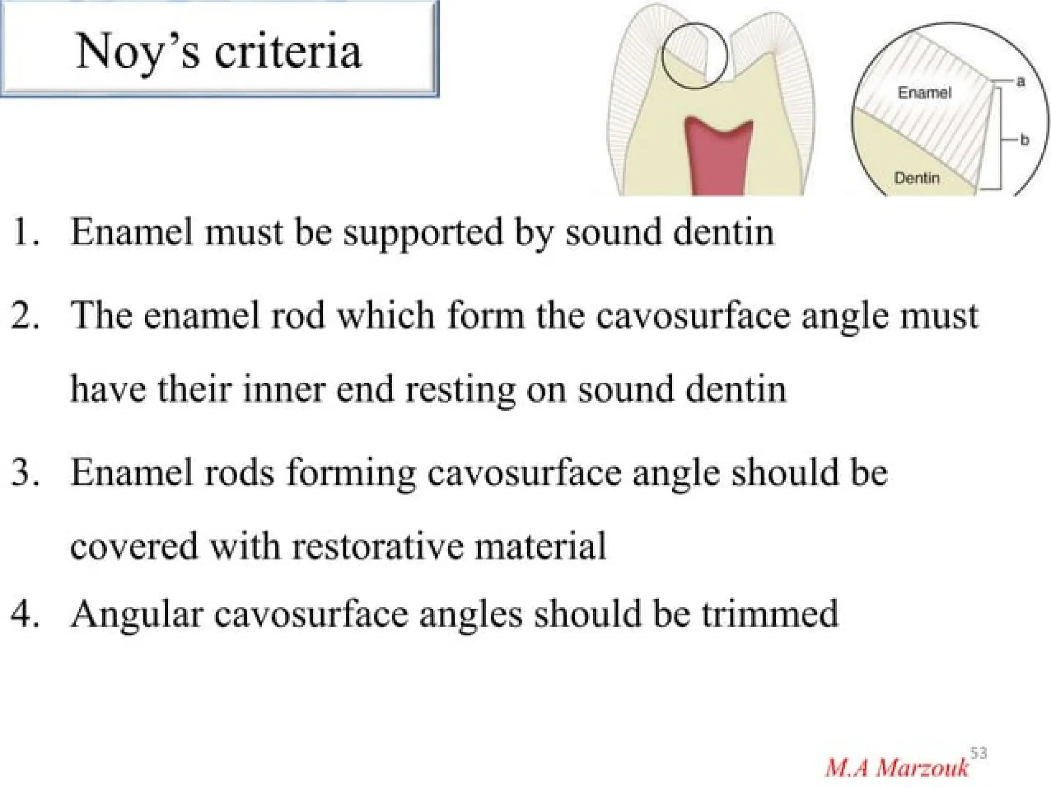 finish lines in fixed partial denture .pptx