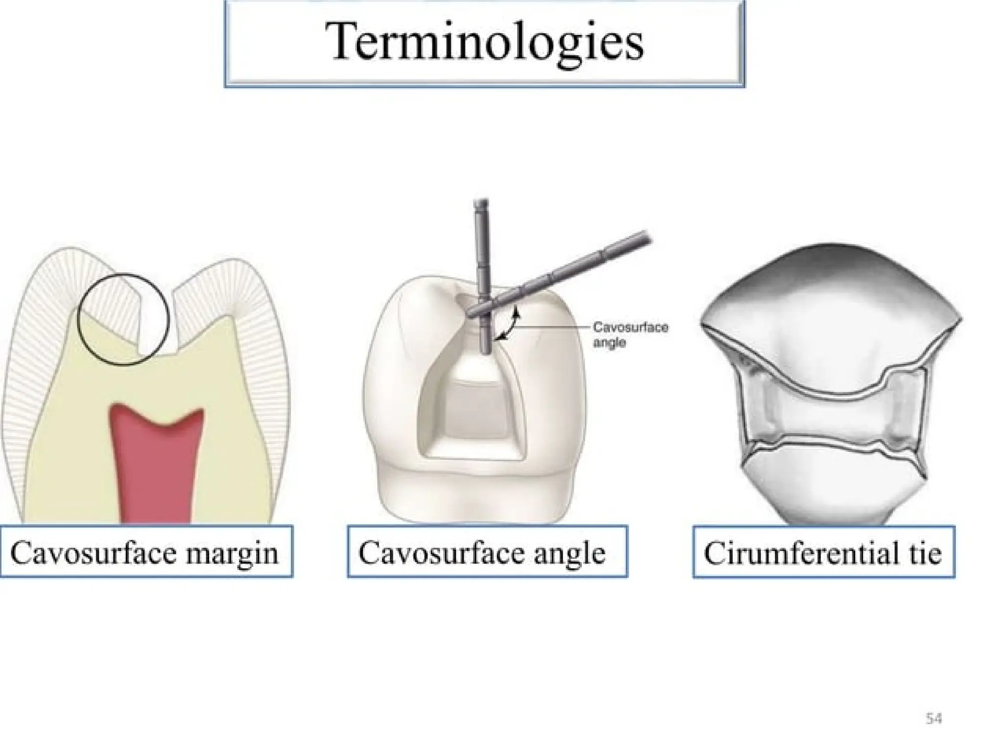 finish lines in fixed partial denture .pptx