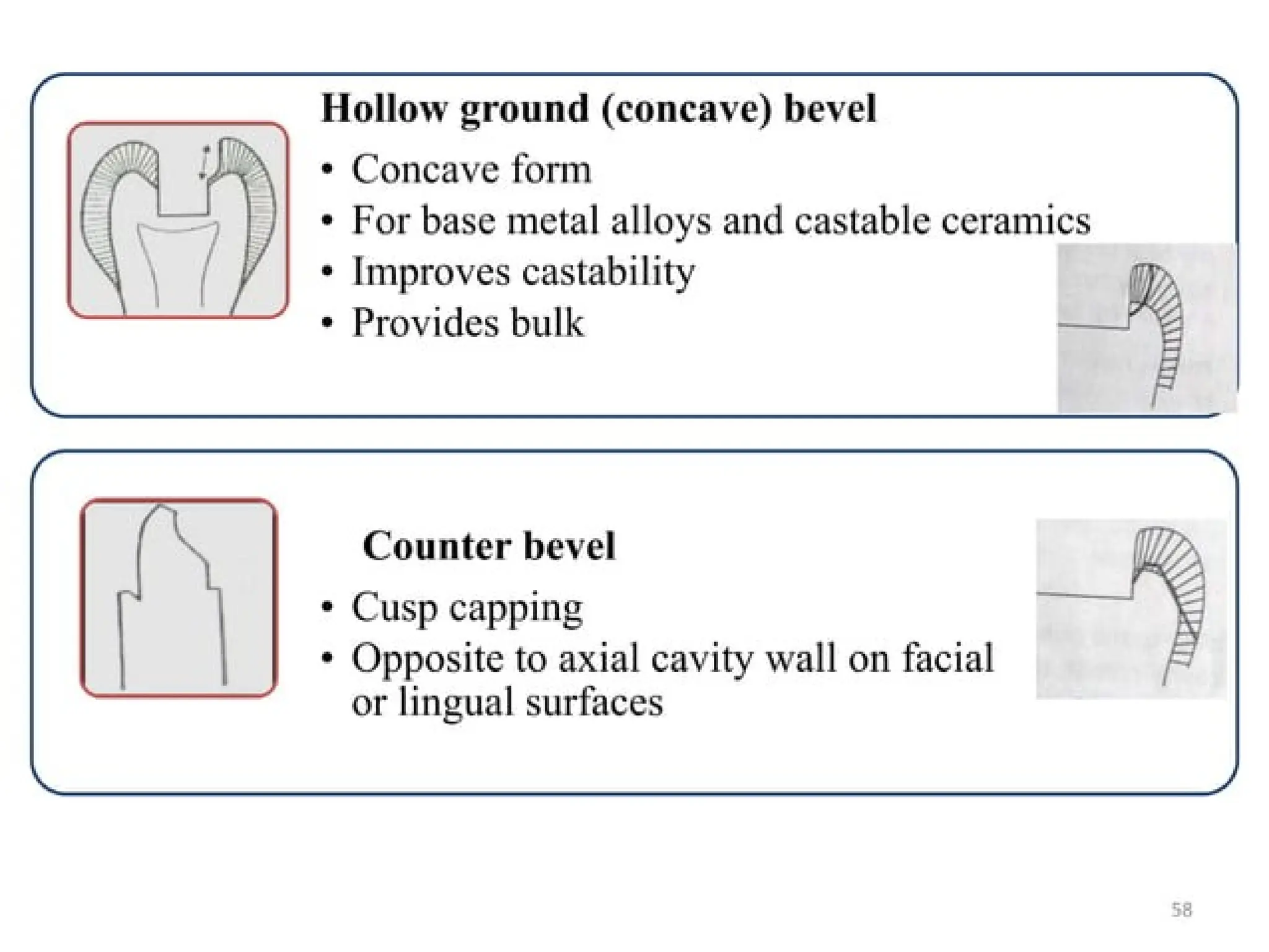 finish lines in fixed partial denture .pptx