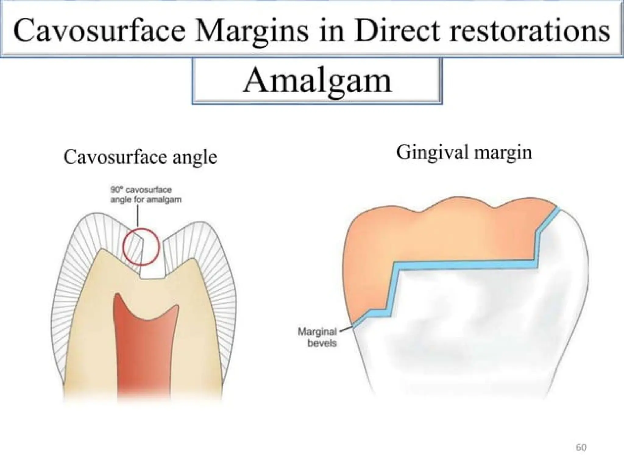 finish lines in fixed partial denture .pptx