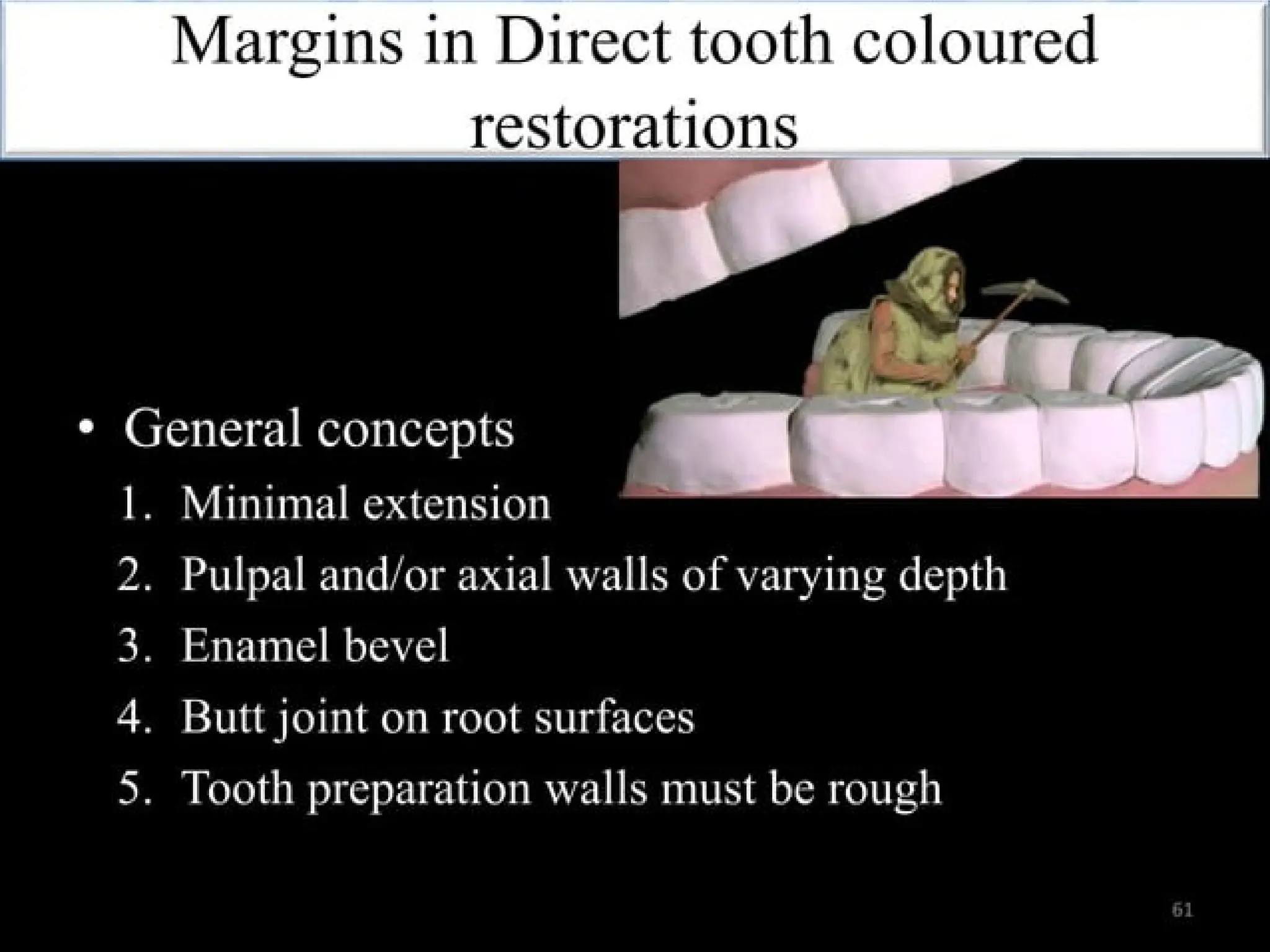 finish lines in fixed partial denture .pptx