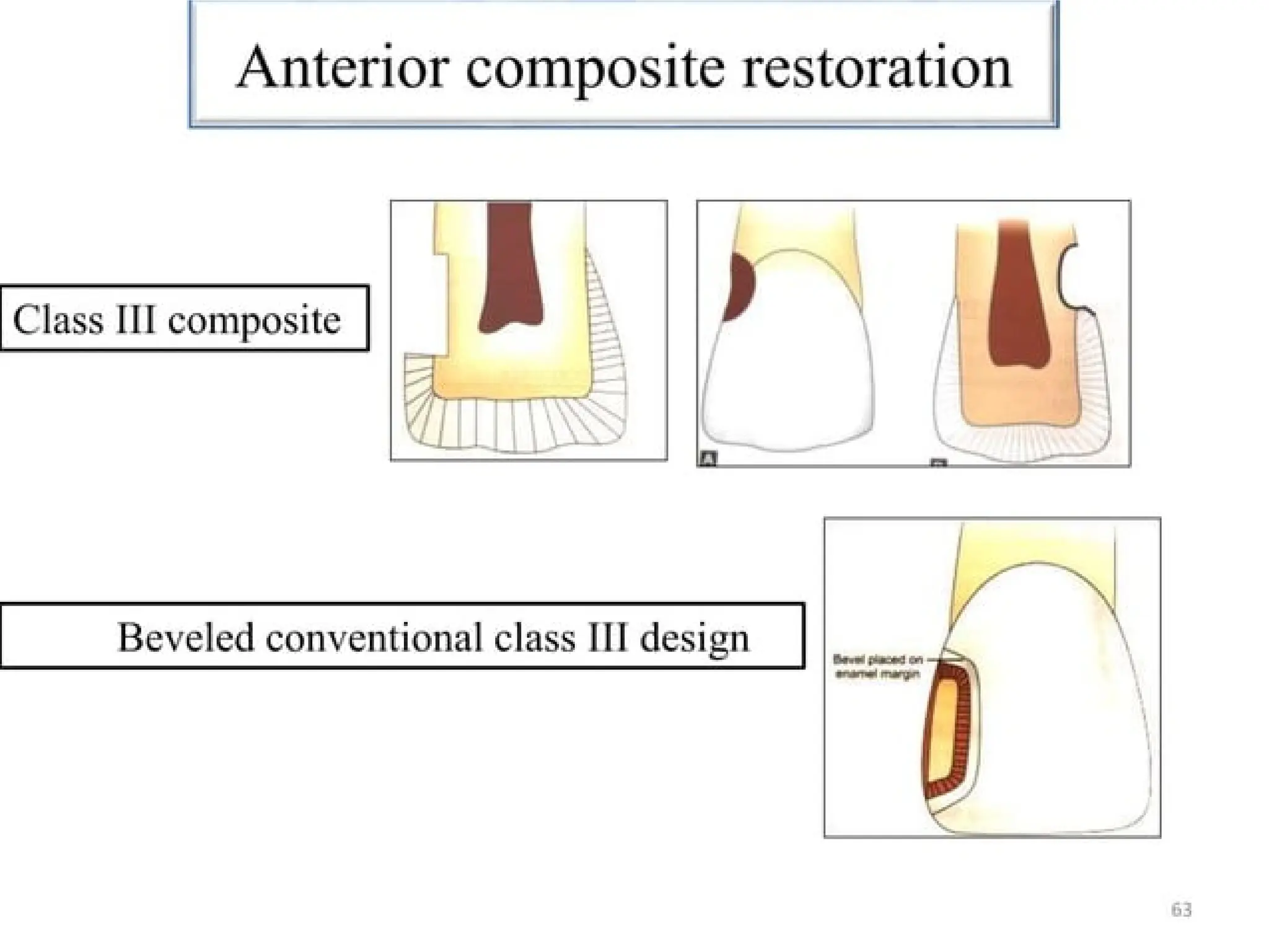 finish lines in fixed partial denture .pptx