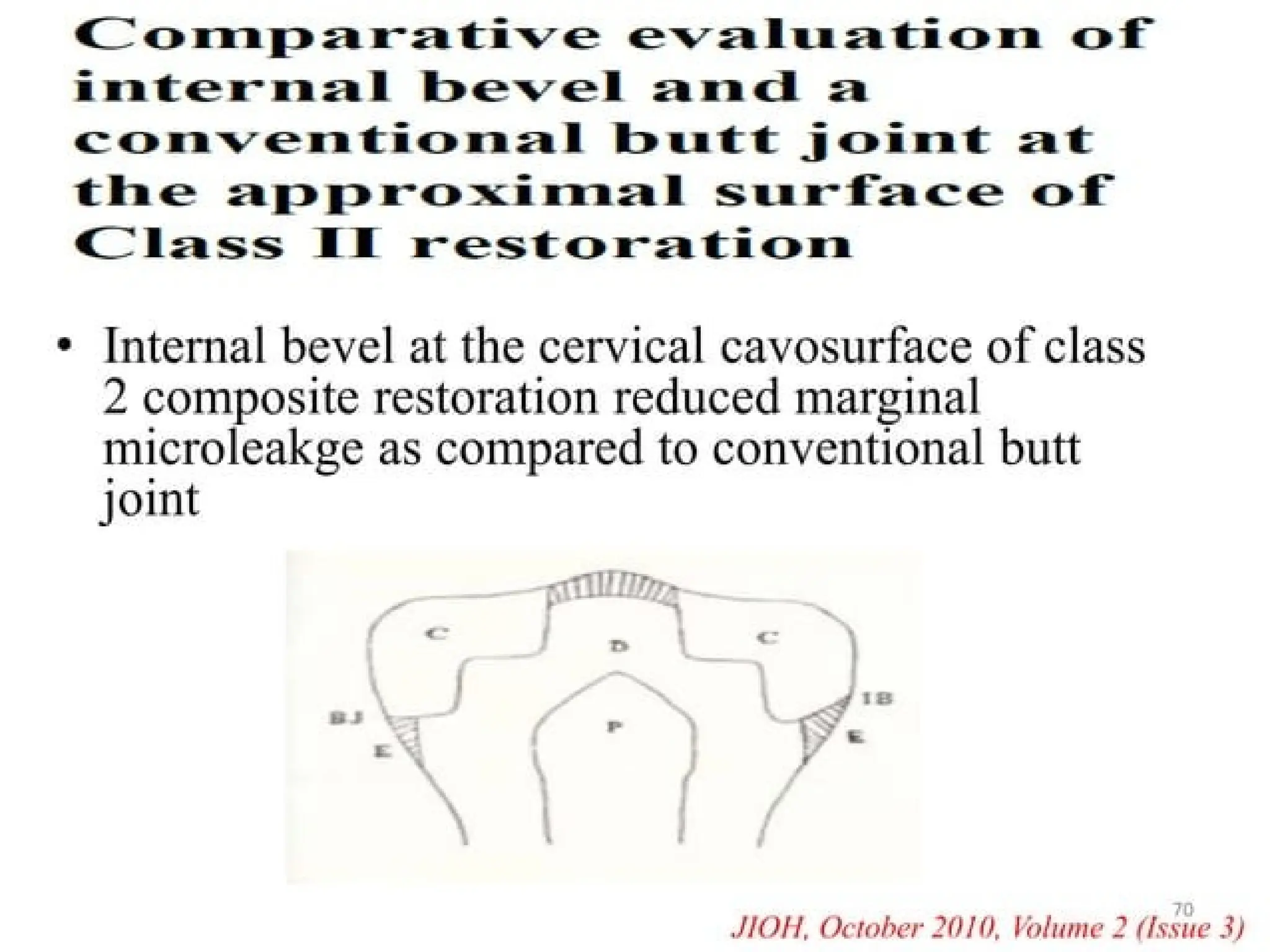 finish lines in fixed partial denture .pptx