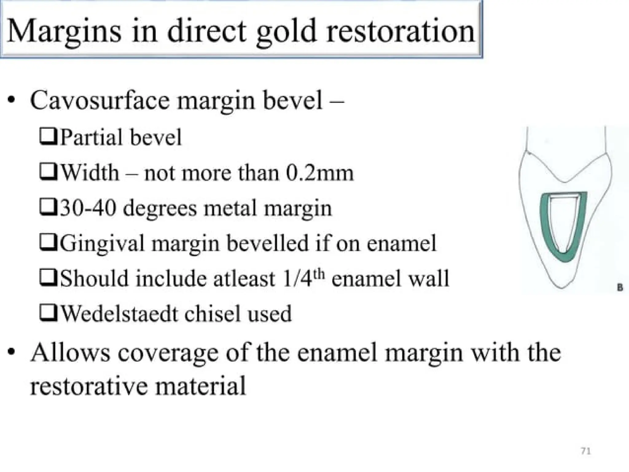 finish lines in fixed partial denture .pptx