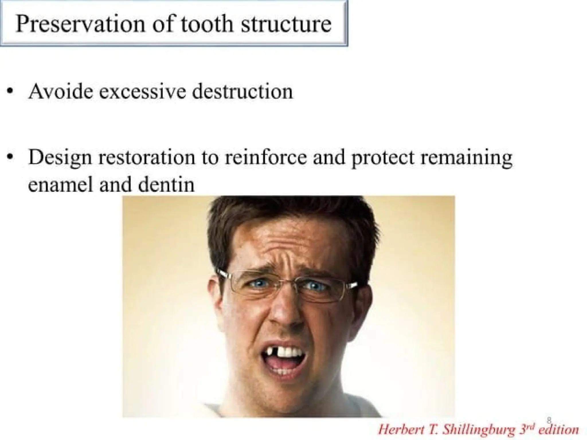 finish lines in fixed partial denture .pptx
