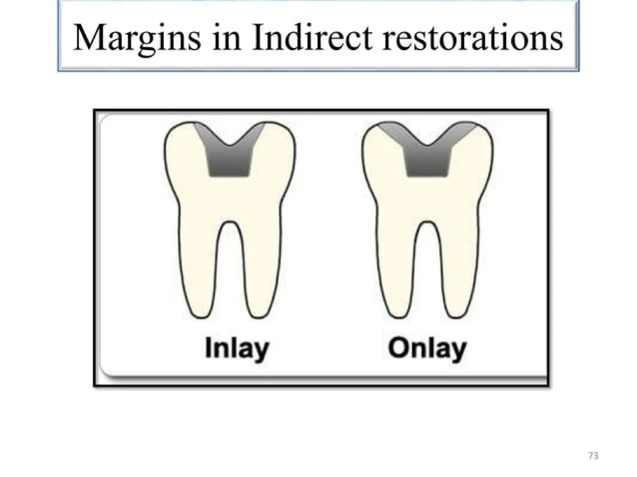 finish lines in fixed partial denture .pptx
