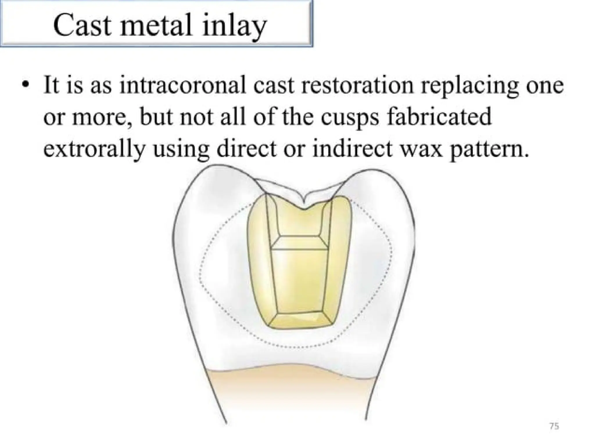 finish lines in fixed partial denture .pptx
