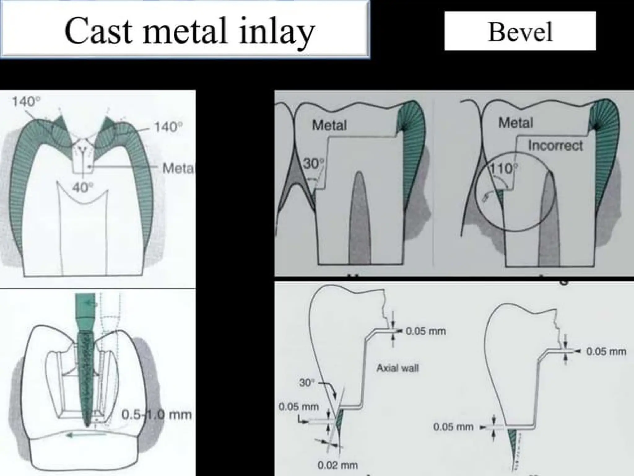 finish lines in fixed partial denture .pptx