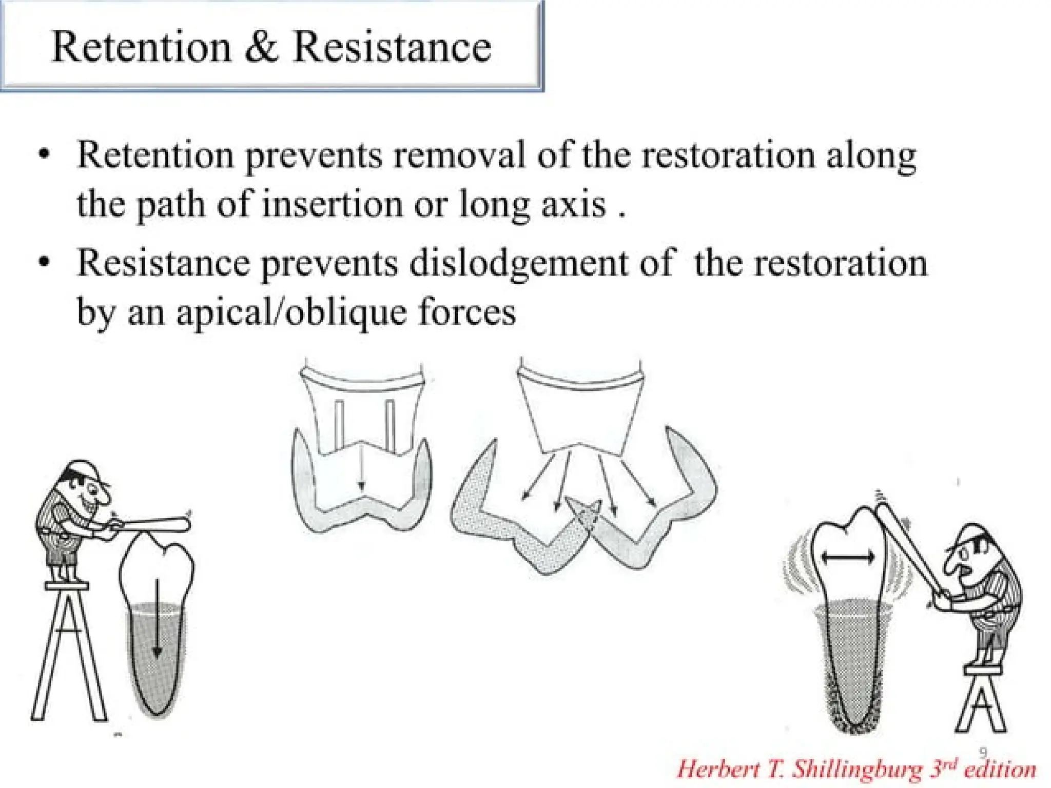 finish lines in fixed partial denture .pptx